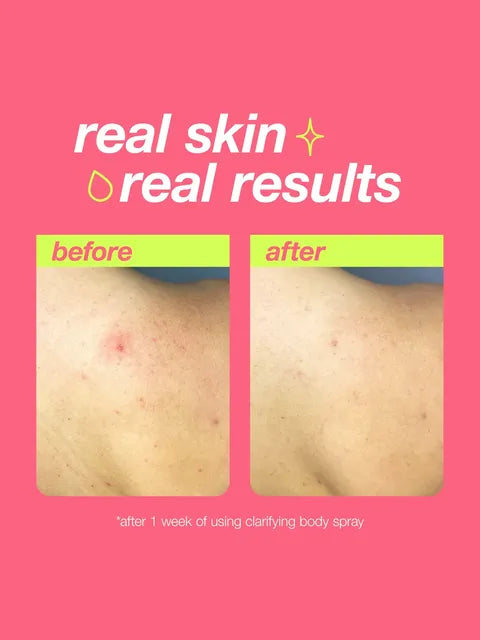 Clarifying Body Spray