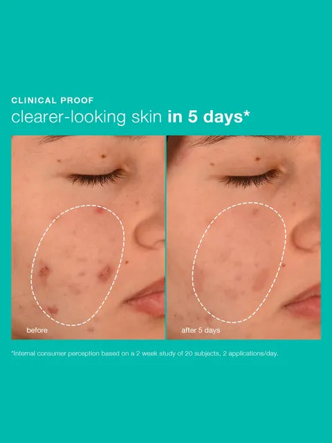 Breakout Biotic Moisturizer